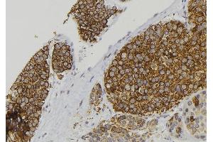 ABIN6277899 at 1/100 staining Human pancreas tissue by IHC-P. (Amylin/DAP 抗体  (Internal Region))