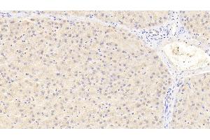 Detection of PCNT in Human Liver Tissue using Polyclonal Antibody to Pericentrin (PCNT) (PCNT 抗体  (AA 2987-3246))