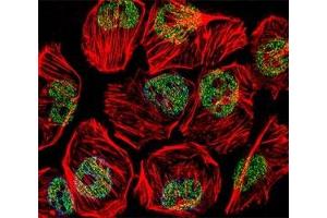 Immunofluorescence (IF) image for anti-TATA Box Binding Protein (TBP) (AA 210-239) antibody (ABIN3029099)
