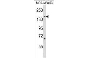 Western blot analysis in MDA-MB453 cell line lysates (35ug/lane). (ARHGEF11 抗体  (AA 605-632))