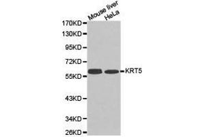 Western Blotting (WB) image for anti-Keratin 5 (KRT5) antibody (ABIN1873489) (Cytokeratin 5 抗体)