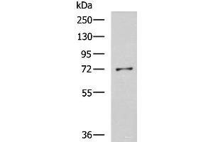 Western blot analysis of K562 cell lysate using GSTCD Polyclonal Antibody at dilution of 1:800 (GSTCD 抗体)