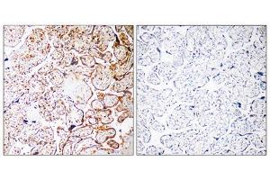 Immunohistochemistry analysis of paraffin-embedded human placenta tissue, using CCDC102B antibody. (CCDC102B 抗体  (Internal Region))