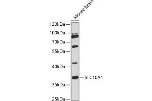 Western blot analysis of extracts of mouse brain, using SLC10 antibody (2721) at 1:3000 dilution. (SLC10A1 抗体  (C-Term))