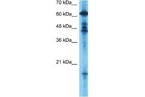 Host:  Rabbit  Target Name:  GCYB1  Sample Type:  Fetal Brain lysates  Antibody Dilution:  0. (GUCY1B3 抗体  (N-Term))