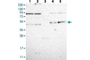 Western blot analysis of Lane 1: RT-4, Lane 2: U-251 MG, Lane 3: Human Plasma, Lane 4: Liver, Lane 5: Tonsil with CDCP2 polyclonal antibody . (CDCP2 抗体)