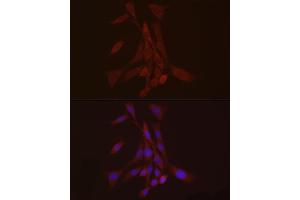 Immunofluorescence (IF) image for anti-S100 Calcium Binding Protein A10 (S100A10) (AA 1-97) antibody (ABIN7270123)