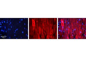 Rabbit Anti-HSPB1 Antibody Catalog Number: ARP30177_T100 Formalin Fixed Paraffin Embedded Tissue: Human Heart Muscle Tissue Observed Staining: Cytoplasm Primary Antibody Concentration: 1:100 Other Working Concentrations: 1:600 Secondary Antibody: Donkey anti-Rabbit-Cy3 Secondary Antibody Concentration: 1:200 Magnification: 20X Exposure Time: 0. (HSP27 抗体  (C-Term))