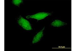Immunofluorescence of purified MaxPab antibody to ANXA11 on HeLa cell. (Annexin A11 抗体  (AA 1-505))
