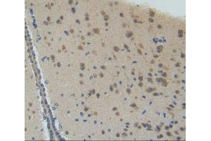 IHC-P analysis of brain tissue, with DAB staining. (CYP26A1 抗体  (AA 250-495))