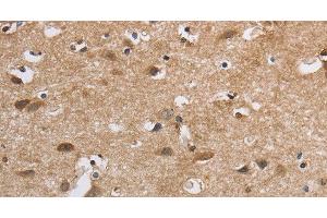Immunohistochemistry of paraffin-embedded Human brain using SDCCAG3 Polyclonal Antibody at dilution of 1:30 (SDCCAG3 抗体)