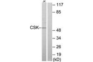 Western blot analysis of extracts from Jurkat cells, using CSK Antibody. (CSK 抗体  (AA 31-80))