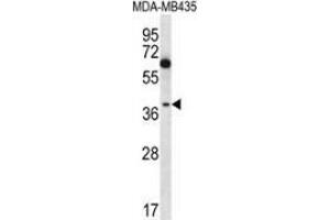 Western blot analysis in MDA-MB435 cell line lysates (35ug/lane) using NFKBIL1  Antibody  (C-term). (NFKBIL1 抗体  (C-Term))