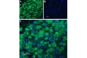 Expression of Serotonin receptor 3B in rat DRG - Immunohistochemical staining of rat dorsal root ganglion (DRG) frozen sections using Anti-5HT3B Receptor (HTR3B) (extracellular) Antibody (ABIN7043622 and ABIN7045285), followed by goat anti-rabbit-AlexaFluor-488 secondary antibody. (Serotonin Receptor 3B 抗体  (Extracellular, N-Term))