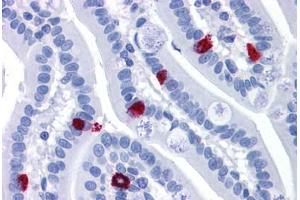 Human Small Intestine: Formalin-Fixed, Paraffin-Embedded (FFPE) (GCC2 抗体  (AA 1174-1185))