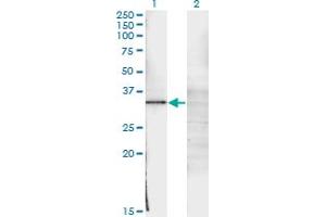 Western Blot analysis of WT1 expression in transfected 293T cell line by WT1 monoclonal antibody (M02), clone 3B12. (WT1 抗体  (AA 349-439))