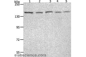 Western blot analysis of 293T, Hela, K562, NIH/3T3 and RAW264. (RAD50 抗体)