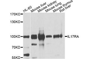 Western blot analysis of extracts of various cells, using IL17RA antibody. (IL17RA 抗体)