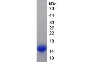 SDS-PAGE analysis of Mouse Hepcidin Protein. (Hepcidin 蛋白)