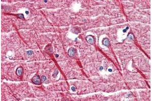 Human Brain, Cortex (formalin-fixed, paraffin-embedded) stained with TNFRSF1A antibody ABIN462093 at 10 µg/ml followed by biotinylated goat anti-rabbit IgG secondary antibody ABIN481713, alkaline phosphatase-streptavidin and chromogen.