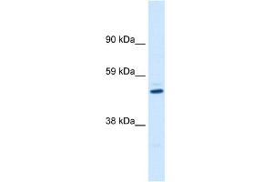 WB Suggested Anti-KCNAB1 Antibody Titration:  0. (KCNAB1 抗体  (C-Term))