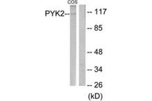 Western Blotting (WB) image for anti-PTK2B Protein tyrosine Kinase 2 beta (PTK2B) (AA 546-595) antibody (ABIN2888606) (PTK2B 抗体  (AA 546-595))