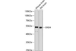 Western blot analysis of extracts of various cell lines, using DRD4 antibody (ABIN1679595, ABIN5663875, ABIN5663877 and ABIN6217338) at 1:1000 dilution. (DRD4 抗体  (AA 100-200))
