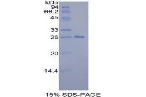 SDS-PAGE analysis of Mouse Tafazzin Protein. (TAZ 蛋白)