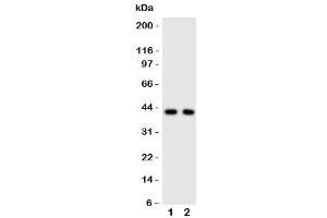 Western blot testing of CXCR5 antibody and Lane 1:  rat spleen (CXCR5 抗体  (C-Term))