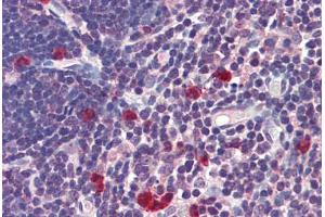 Human Thymus: Formalin-Fixed, Paraffin-Embedded (FFPE) (Caspase 9 抗体  (AA 299-318))