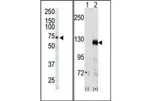 (LEFT)Western blot analysis of anti-EphA3 Pab in CHO cell lysate. (EPH Receptor A3 抗体  (C-Term))
