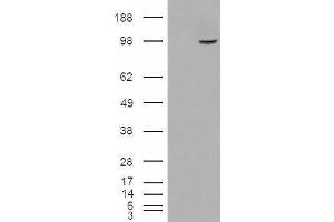 Western Blotting (WB) image for anti-Serine/threonine-Protein Phosphatase 4 Regulatory Subunit 3A (SMEK1) antibody (ABIN5905179) (SMEK1 抗体)