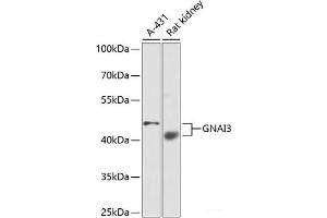 Western blot analysis of extracts of various cell lines using GNAI3 Polyclonal Antibody at dilution of 1:1000. (GNAI3 抗体)
