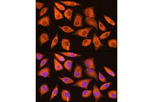 Immunofluorescence analysis of L929 cells using MDM2 antibody (ABIN6133186, ABIN6143671, ABIN6143672 and ABIN6217278) at dilution of 1:100. (MDM2 抗体  (AA 200-430))
