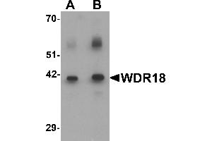Western blot analysis of WDR18 in rat lung tissue lysate with WDR18 antibody at (A) 0. (WDR18 抗体  (C-Term))