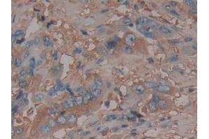 Immunohistochemistry (IHC) image for anti-Serpin Family C Member 1 (SERPINC1) antibody (ABIN7426502)