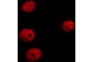 ABIN6267526 staining HepG2 cells by ICC/IF. (GATA4 抗体  (pSer105))