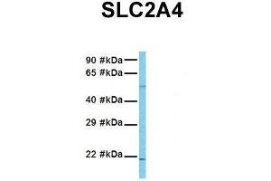 Western Blotting (WB) image for anti-Solute Carrier Family 2 (Facilitated Glucose Transporter), Member 4 (SLC2A4) (N-Term) antibody (ABIN2781558)