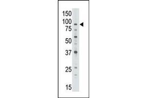 Western Blotting (WB) image for anti-ATP-Binding Cassette, Sub-Family B (MDR/TAP), Member 7 (ABCB7) (AA 718-746), (C-Term) antibody (ABIN390062)