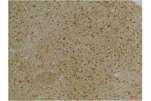 Immunohistochemical analysis of paraffin-embedded Mouse BrainTissue using KCNN2(SK2) Rabbit pAb diluted at 1:200. (KCNN2 抗体)