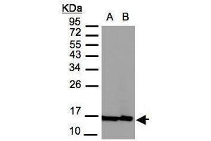 WB Image Sample(30 μg of whole cell lysate) A:MOLT4, B:Raji, 12% SDS PAGE antibody diluted at 1:3000