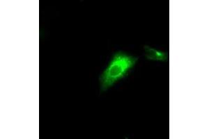 Image no. 6 for anti-Lipase, Endothelial (LIPG) antibody (ABIN1499169) (LIPG 抗体)