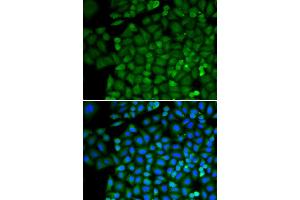 Immunofluorescence analysis of HeLa cell using SELENBP1 antibody. (SELENBP1 抗体)