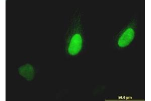 Immunofluorescence of monoclonal antibody to PUM2 on HeLa cell. (PUM2 抗体  (AA 106-205))