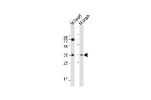 All lanes : Anti-HUN-LDHB at 1:2000 dilution Lane 1: Mouse heart whole cell lysate Lane 2: Mouse brain whole cell lysate Lysates/proteins at 20 μg per lane. (LDHB 抗体  (AA 220-250))