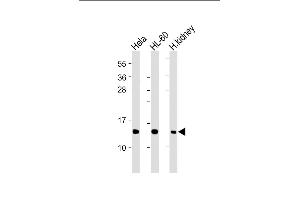 All lanes : Anti-ND4L Antibody (C-term) at 1:2000 dilution Lane 1: Hela whole cell lysate Lane 2: HL-60 whole cell lysate Lane 3: Human kidney lysate Lysates/proteins at 20 μg per lane. (MT-ND4L 抗体  (C-Term))