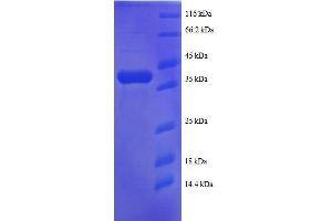 Ribosomal Protein S25 (RPS25) (AA 1-125), (full length) protein (GST tag)