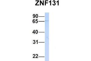 Host:  Rabbit  Target Name:  ZNF131  Sample Type:  Hela  Antibody Dilution:  1. (ZNF131 抗体  (N-Term))