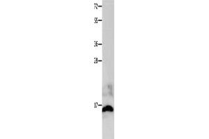Gel: 12 % SDS-PAGE, Lysate: 40 μg, Lane: Mouse brain tissue, Primary antibody: ABIN7191217(KISS1 Antibody) at dilution 1/100, Secondary antibody: Goat anti rabbit IgG at 1/8000 dilution, Exposure time: 20 seconds (KISS1 抗体)