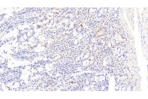 Detection of DR5 in Human Small intestine Tissue using Polyclonal Antibody to Death receptor 5 (DR5) (TNFRSF10B 抗体  (AA 234-435))
